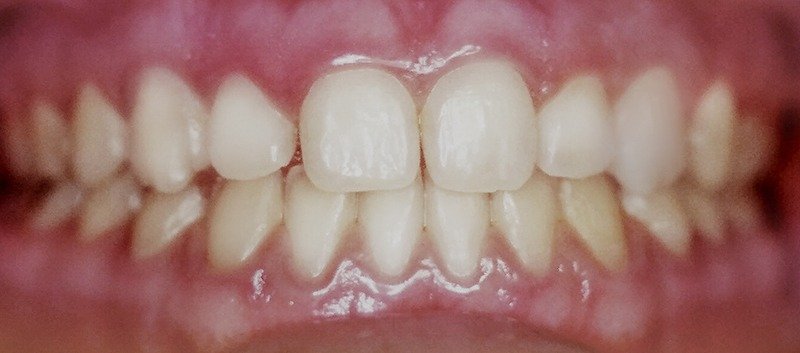 Periodontia Egos Clínica Odontológica 4459